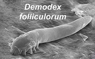 Demodex Mites: Link to Chronic Dry Eye Issues Explained