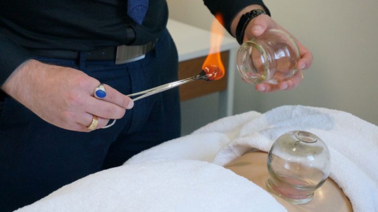 Cupping Therapy Benefits: Heal in Melbourne Today