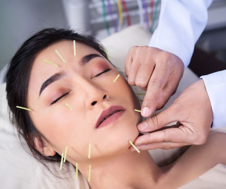 Cosmetic Acupuncture: Important Disadvantages to Know